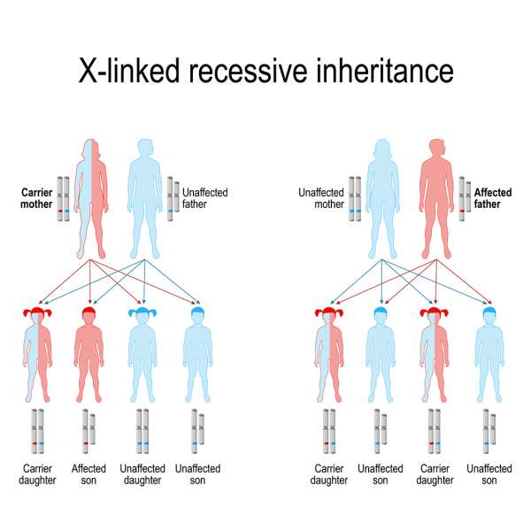 Color Blindness Pattern Of Inheritance ~ Wallpaper Eman 